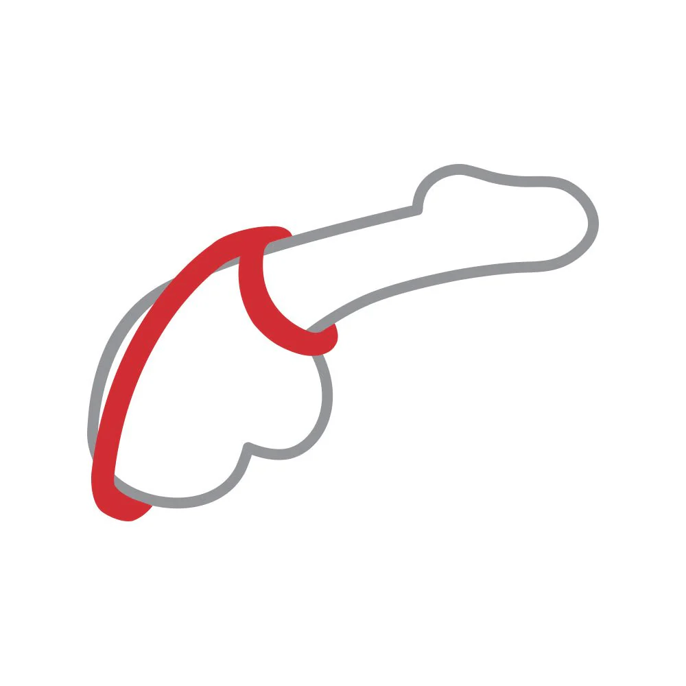 RingMaster Custom Fit Dual Support Ring - Image 4