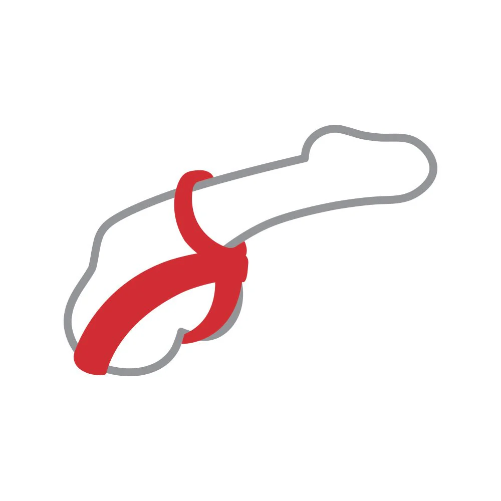 RingMaster Silicone Snap Ball Spreader - Image 4