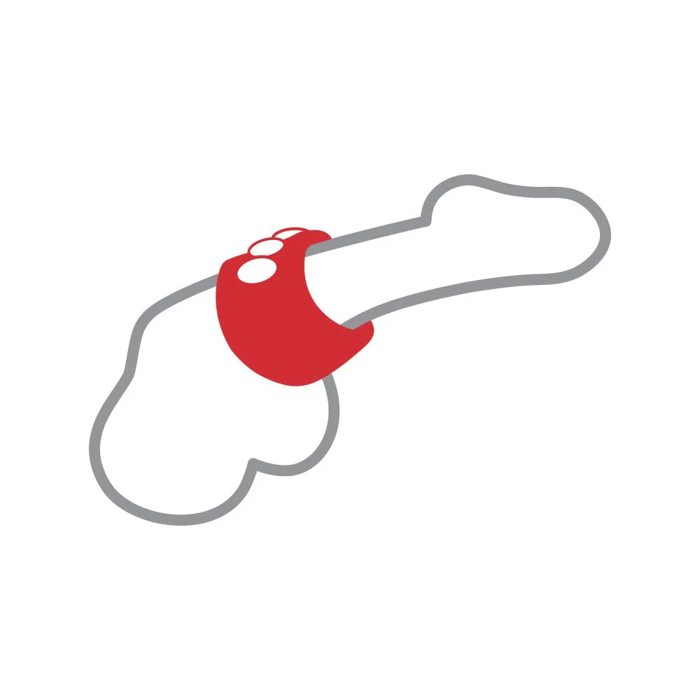 RingMaster Silicone Snap Support Ring - Image 5